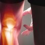 ACLanterior Cruciate Ligament Injury - Mayfair Wellness Clinic Gulshan