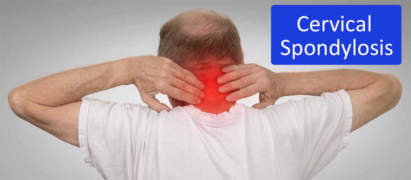 Cervical Spondylosis - Mayfair Wellness Clinic Gulshan