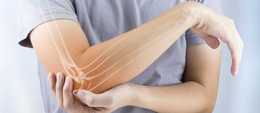 Cubital Tunnel Syndrome - Mayfair Wellness Clinic Gulshan