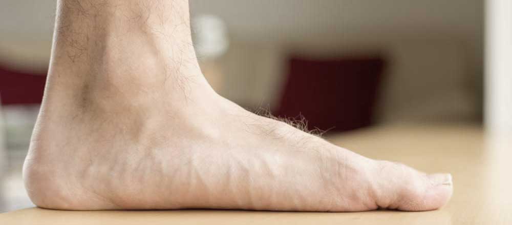 Flat Foot Tratment - Mayfair Wellness Clinic Gulshan