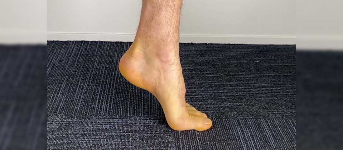 Heel Pad Syndrome - Mayfair Wellness Clinic Gulshan