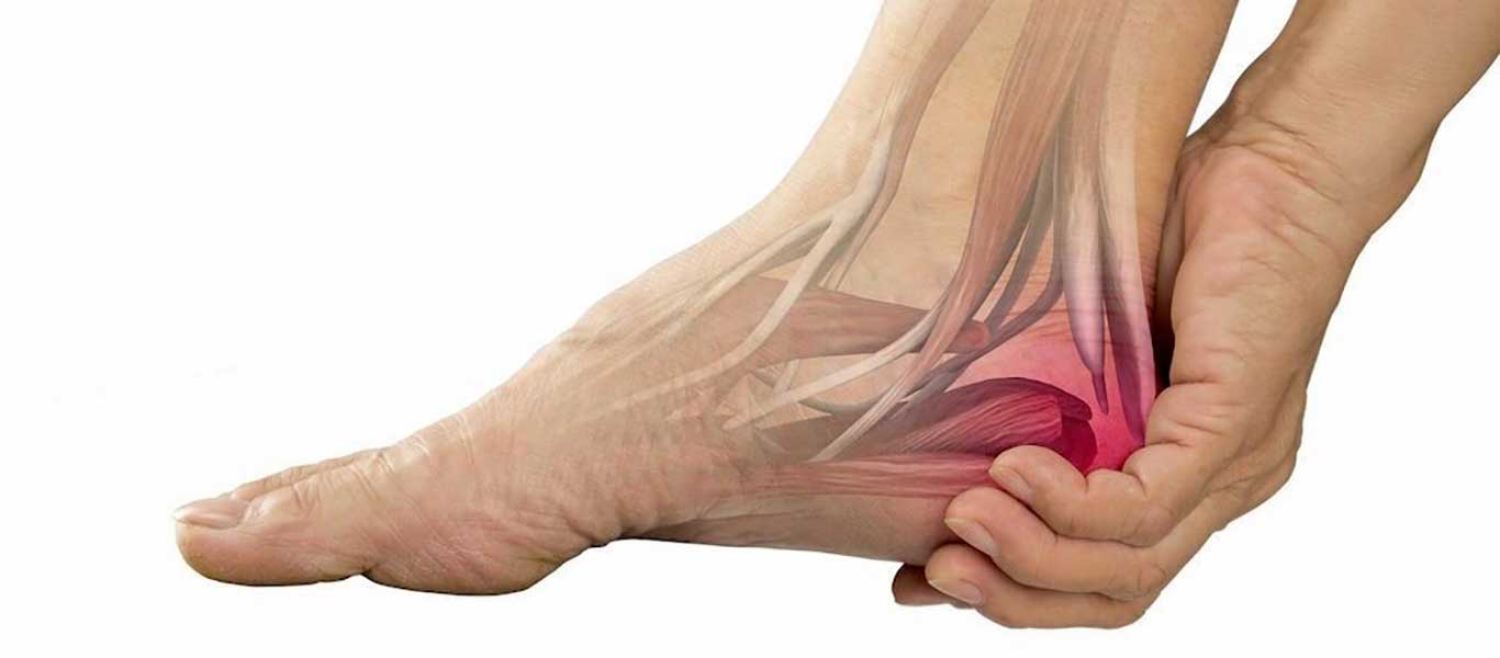 Peroneal Tendonitis - Mayfair Wellness Clinic Gulshan
