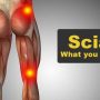 Sciatica What You Need To Know - Mayfair Wellness Clinic Gulshan