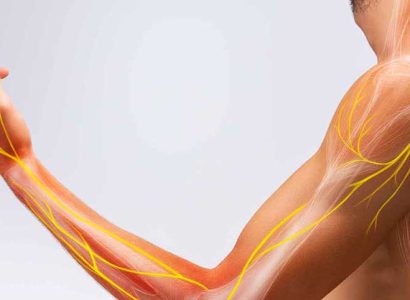 Thoracic Outlet Syndrome - Mayfair Wellness Clinic Gulshan