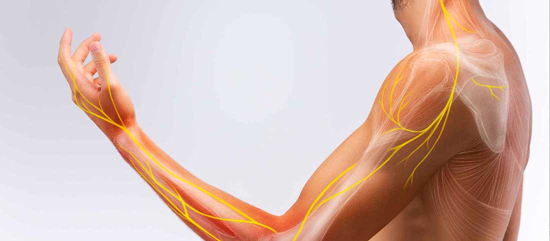 Thoracic Outlet Syndrome - Mayfair Wellness Clinic Gulshan