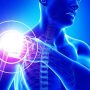 Bicespstendinopath Mayfairy - Mayfair Wellness Clinic Gulshan