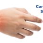 Carpaltunnel1364 - Mayfair Wellness Clinic Gulshan