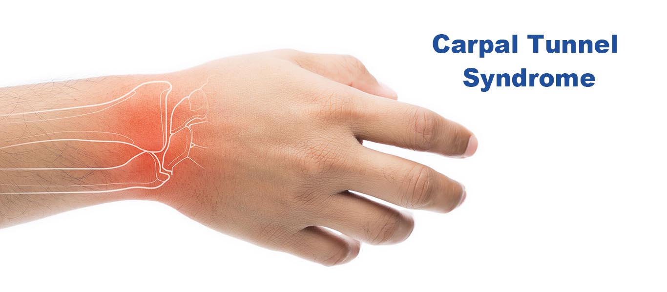 Carpaltunnel1364 - Mayfair Wellness Clinic Gulshan
