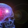 Motor Neuron Deasis Bg - Mayfair Wellness Clinic Gulshan