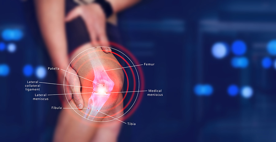 Human,Knee,Joint,Anatomical,Diagram,,Medical,Scheme.,Educational,Information,Template. - Mayfair Wellness Clinic Gulshan