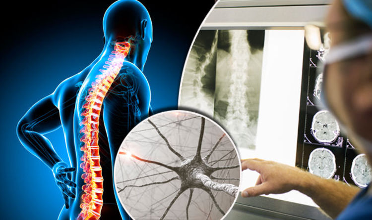 Motor Neuron Disease - Mayfair Wellness Clinic Gulshan