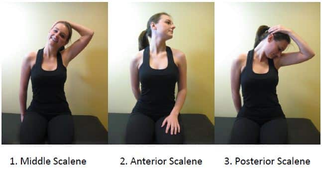 Thoracic Outlet Syndrome 5 Thoracic Outlet Syndrome2 Thoracic Outlet Syndrome