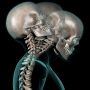 Whiplash Injury - Mayfair Wellness Clinic Gulshan