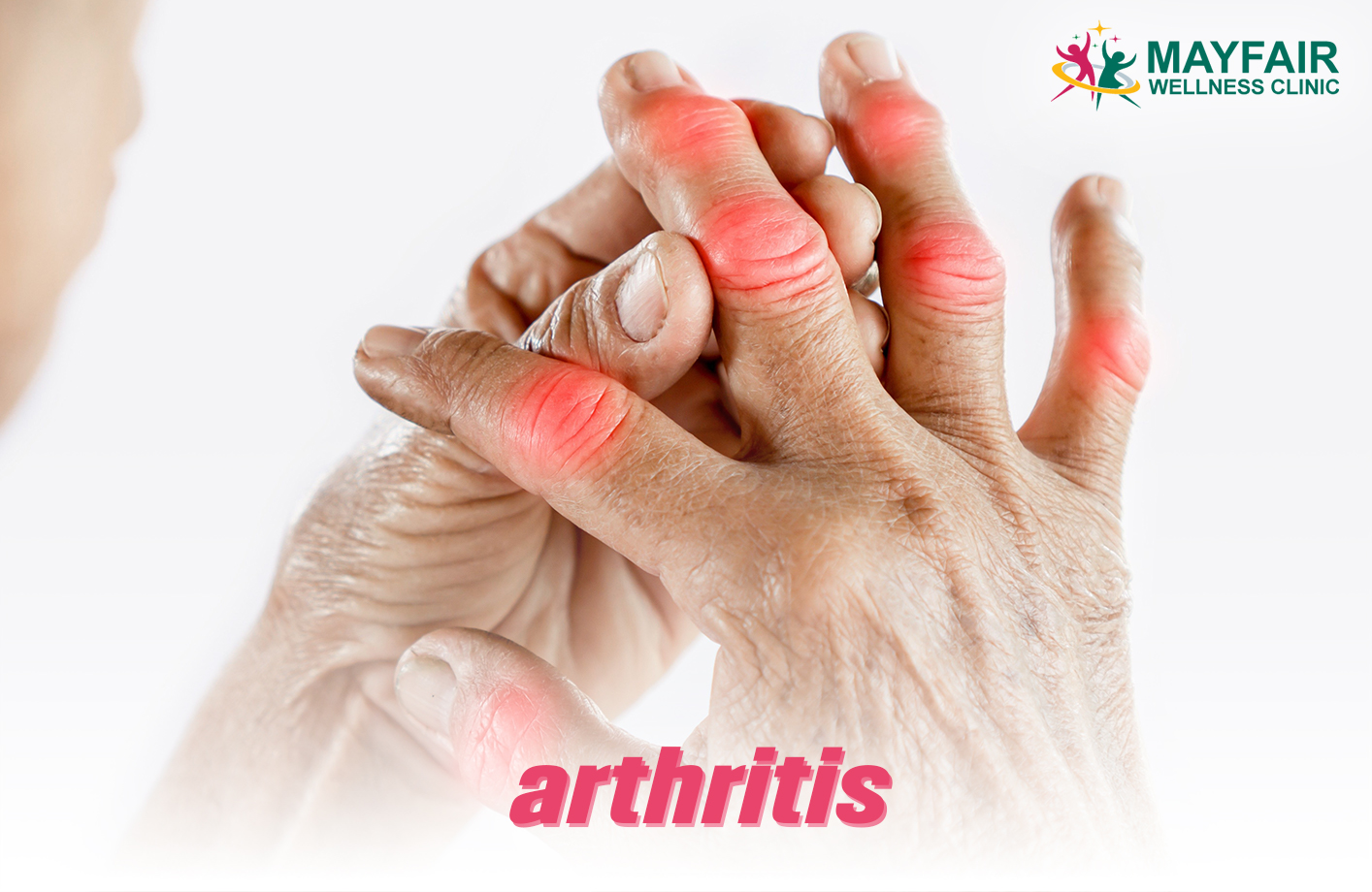 Rheumatoid Arthritis Joint Pain Mayfair - Mayfair Wellness Clinic Gulshan